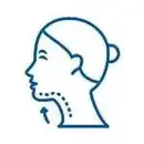 Chin Liposuction Cost